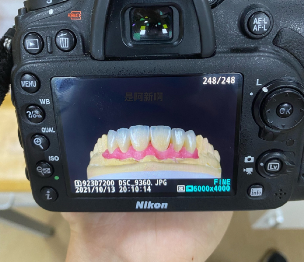 Emax crown