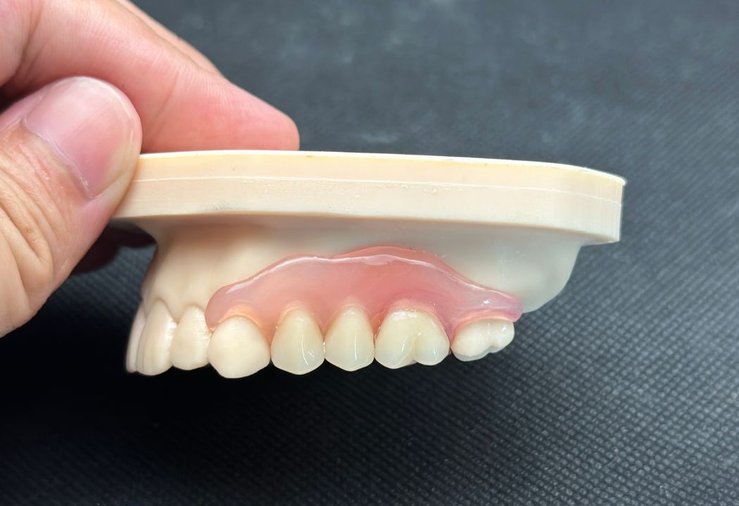 valplast-隐形牙2.jpg