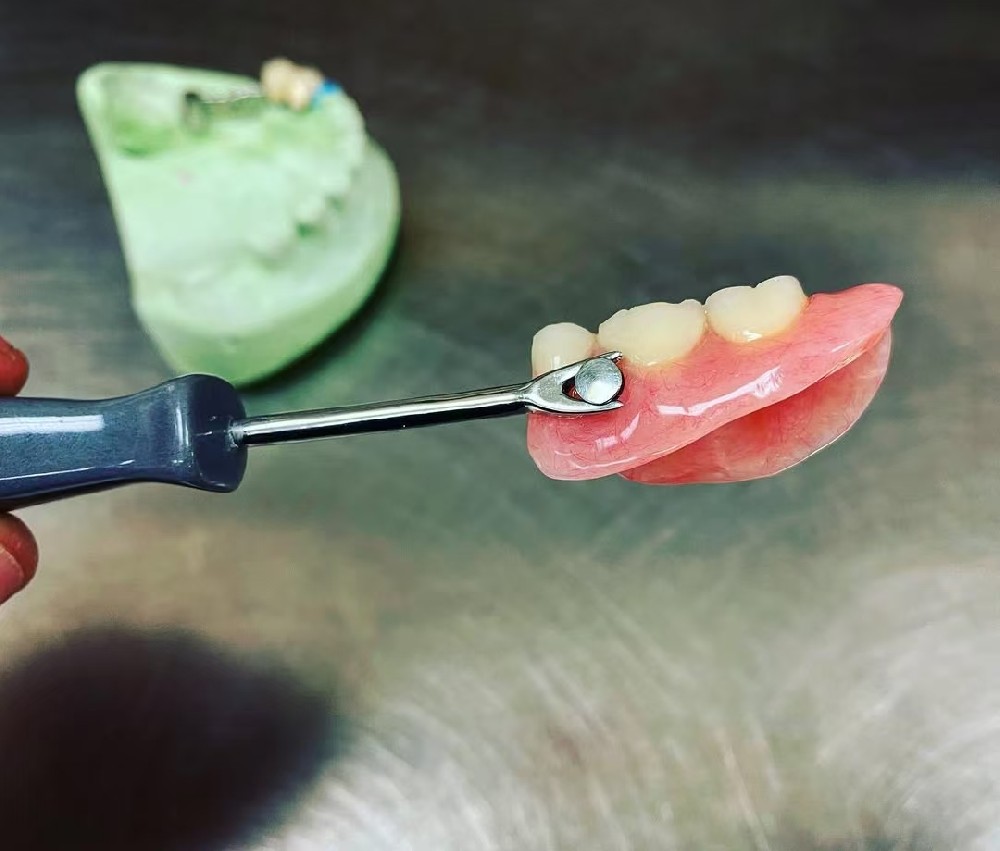 MK1 Attachment Dentures
